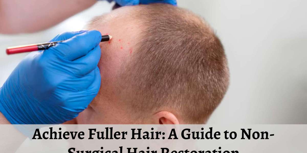 Achieve Fuller Hair: A Guide to Non-Surgical Hair Restoration